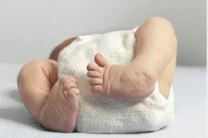 Clubfoot Correction Surgery