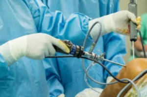 Knee Replacement Surgery